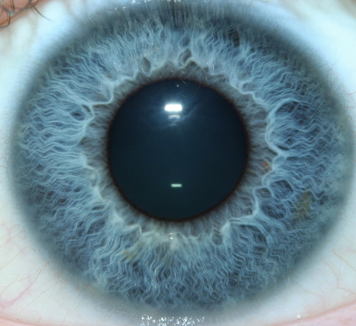 iridology pictures 1
