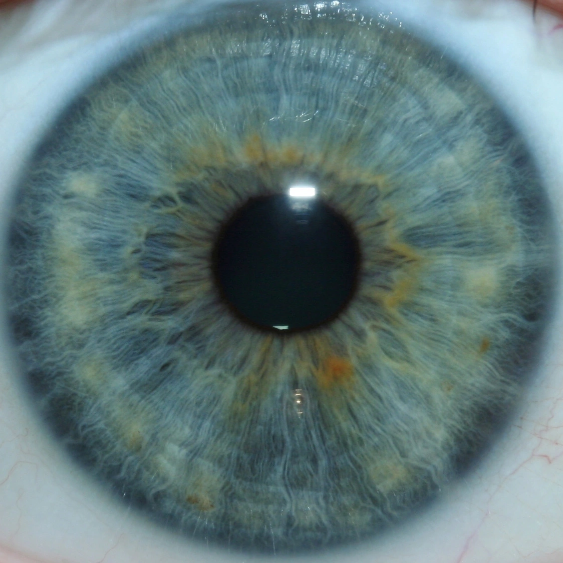 iridology pictures 7