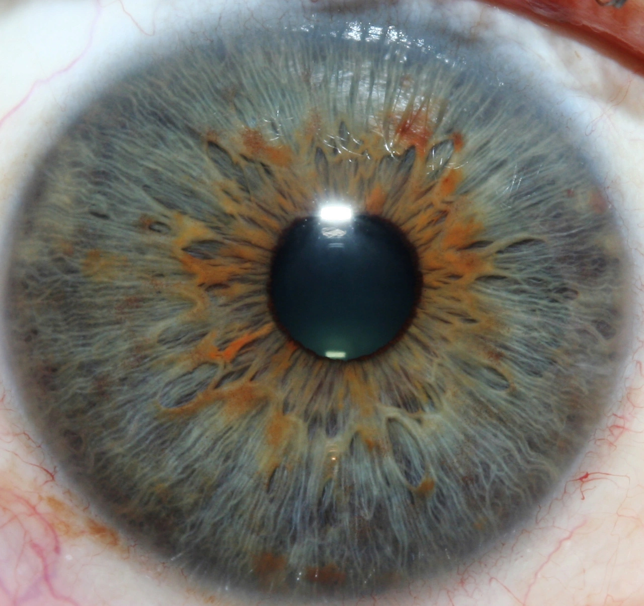iridology pictures 8