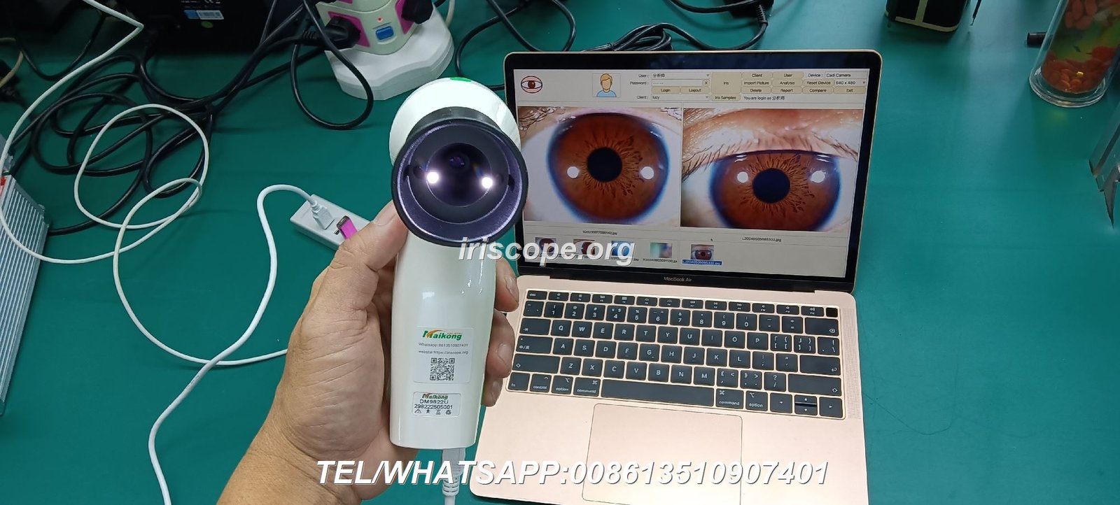 Iriscope profesional MAIKONG 12MP con iluminación LED y diseño ergonómico para análisis de iris