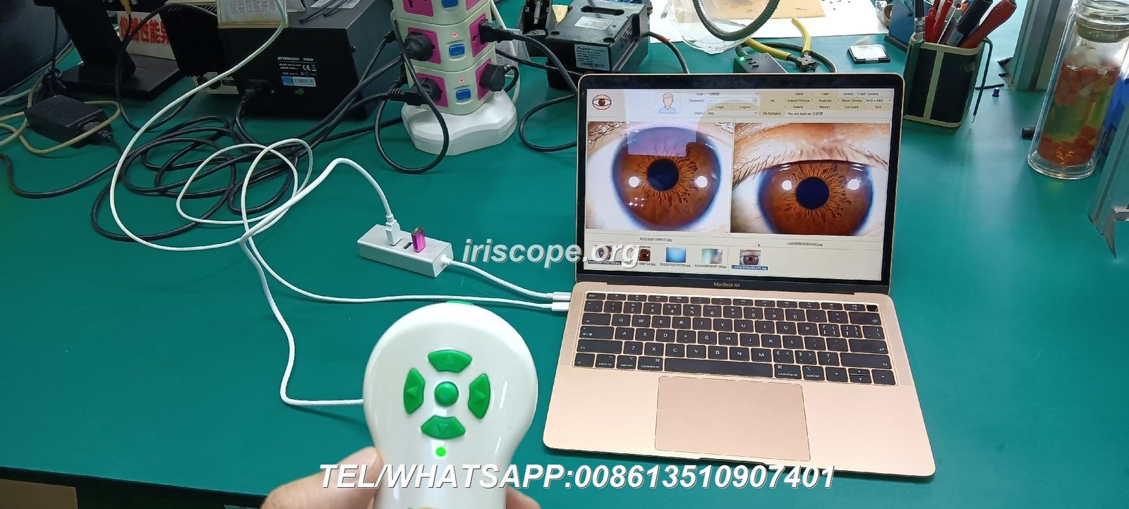 iridology camera iriscopio