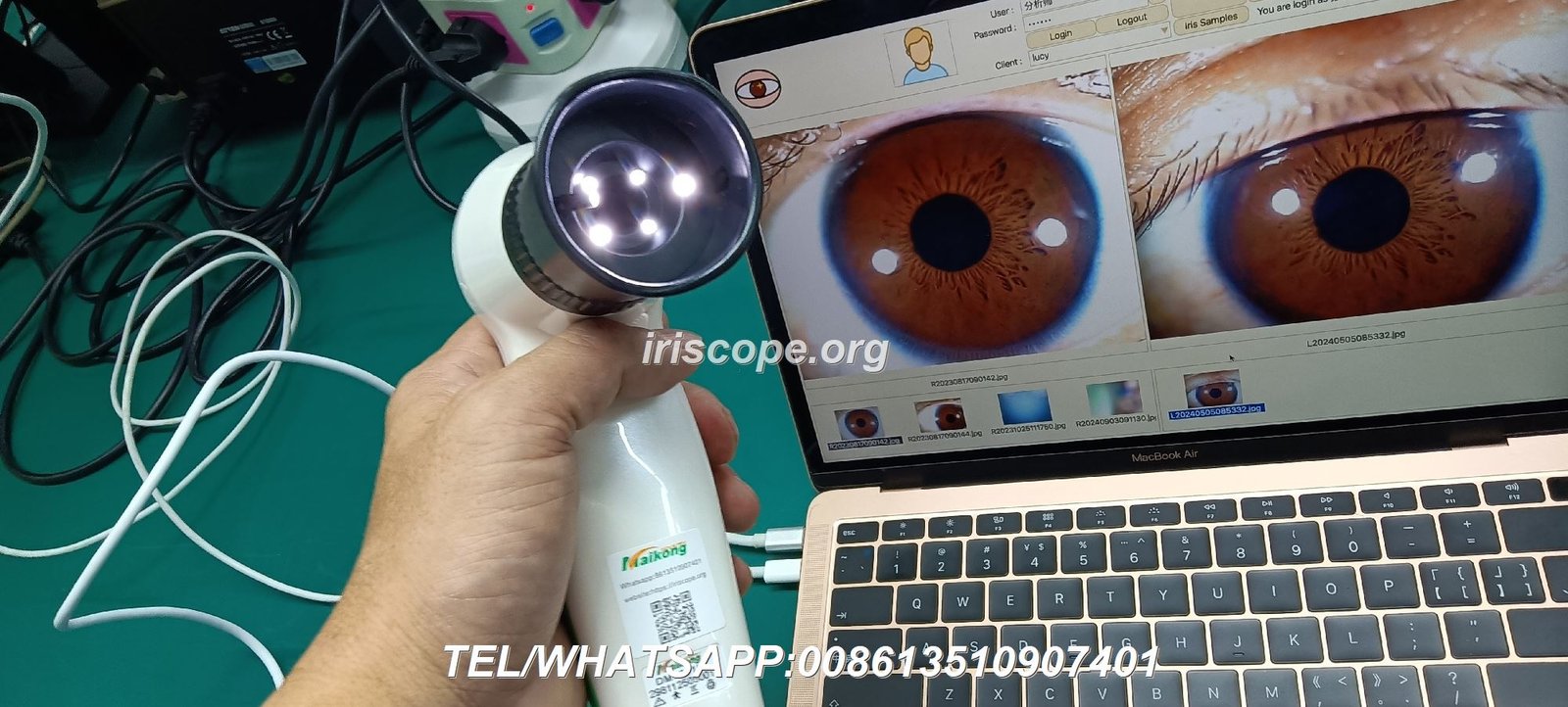 iridology camera iriscopio