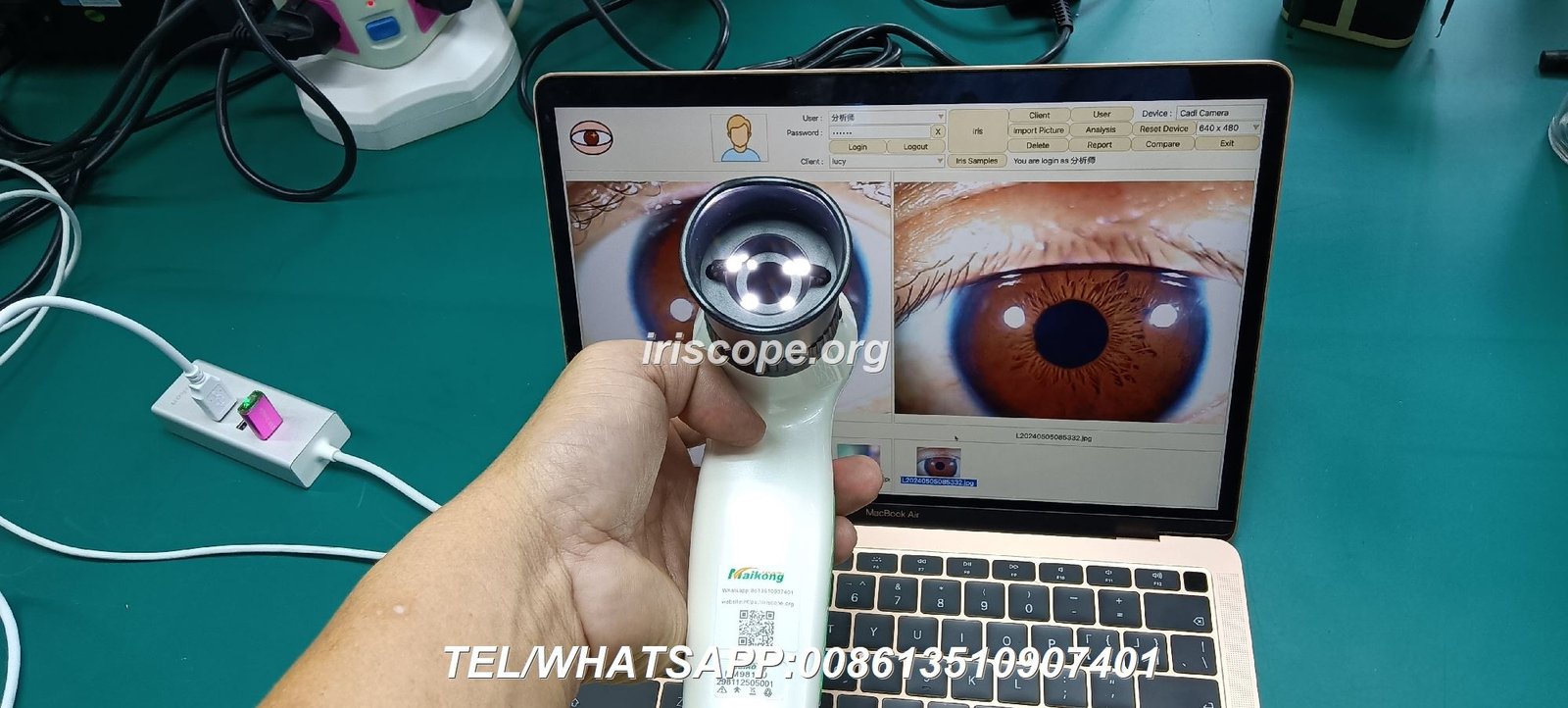 Iridology Cam
