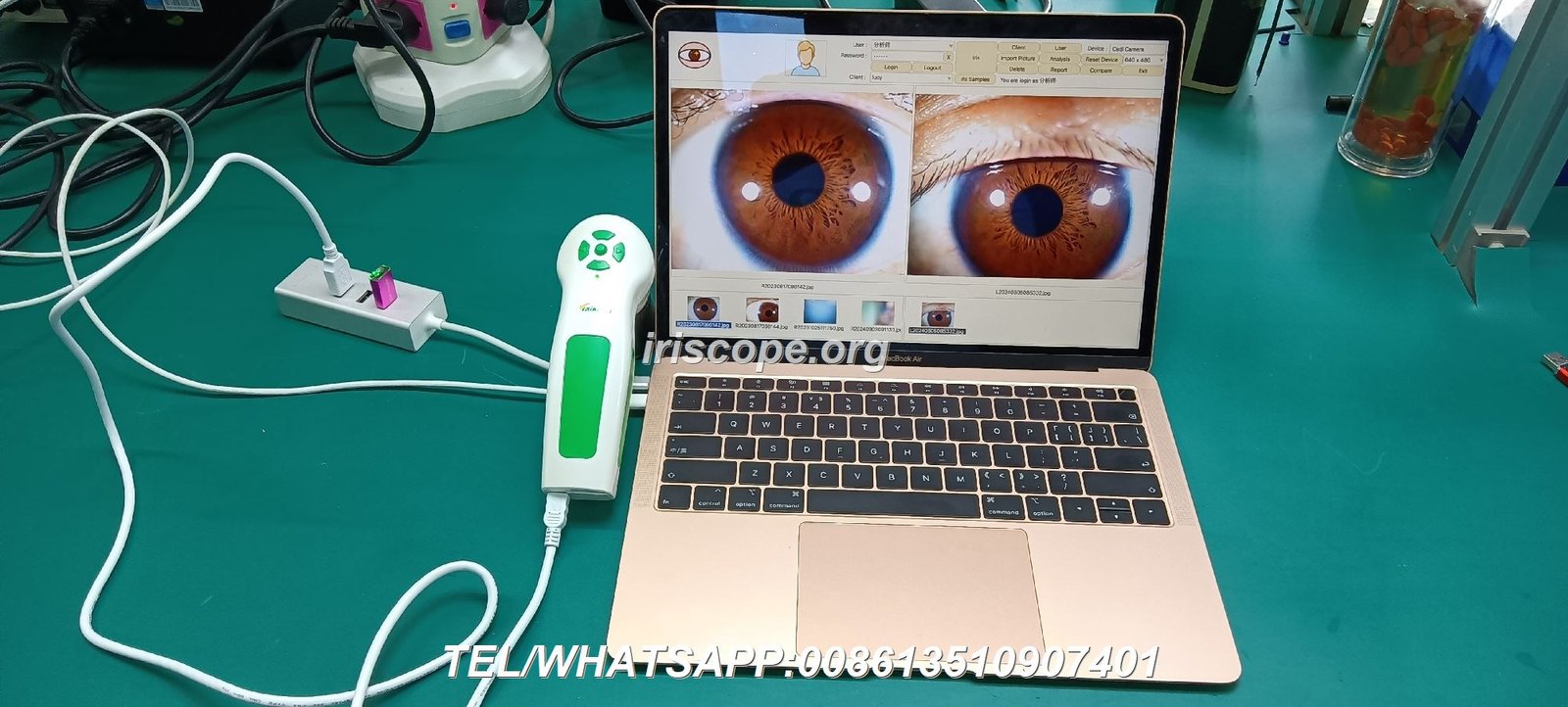 iridology camera