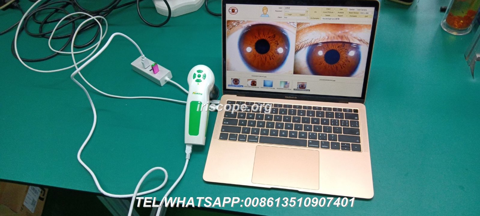 Componentes técnicos del iriscope profesional