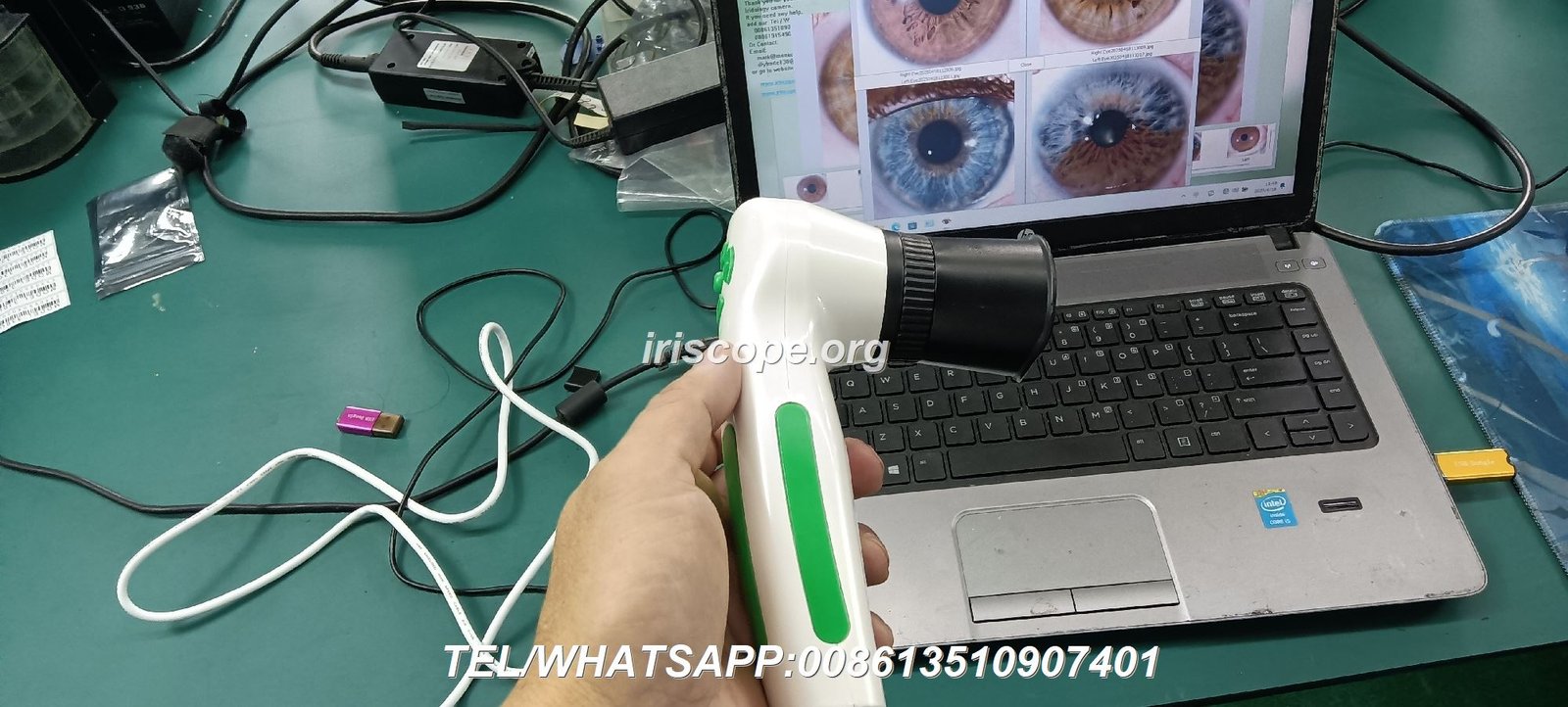 iriscope iridology cam