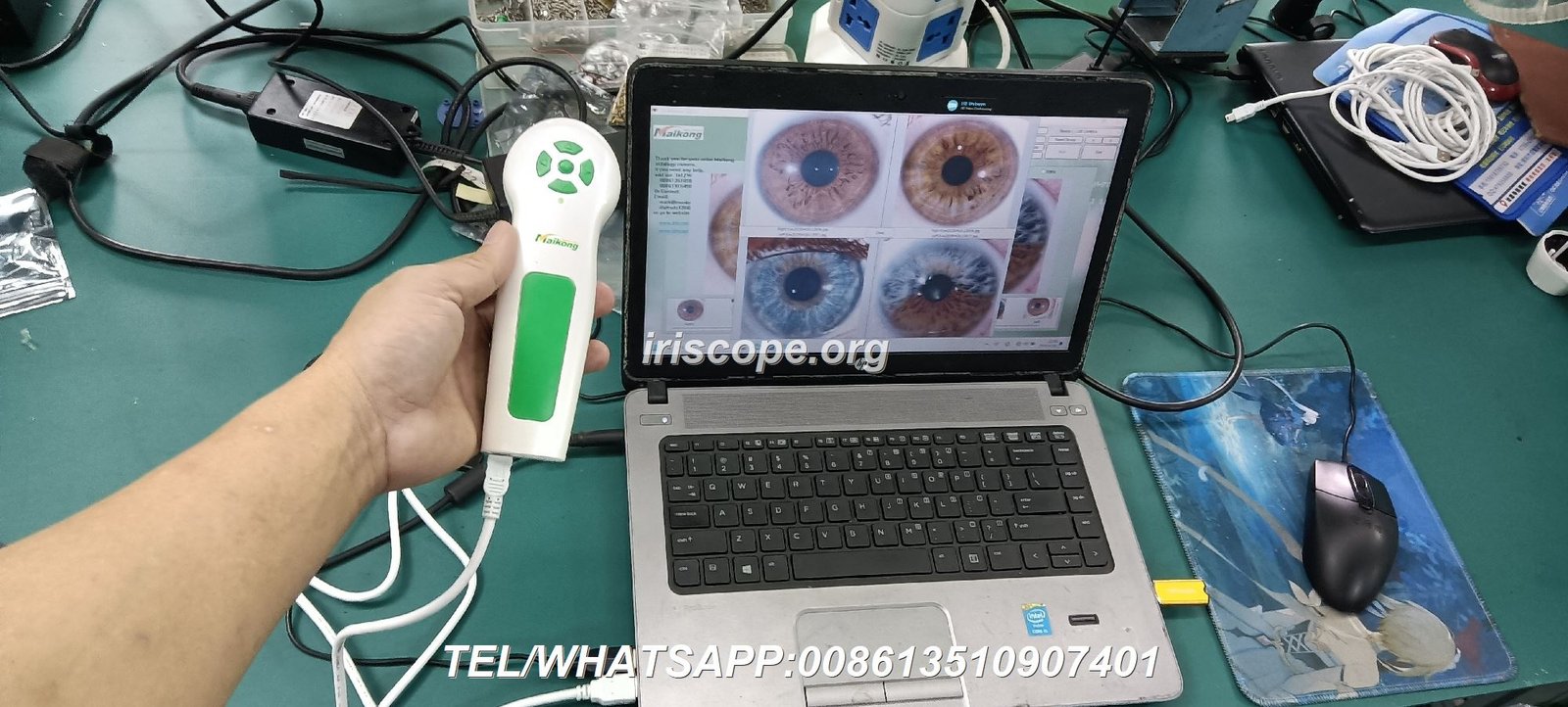 iriscope iridology cam