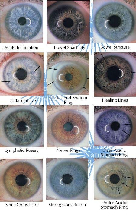 Iridology eye color