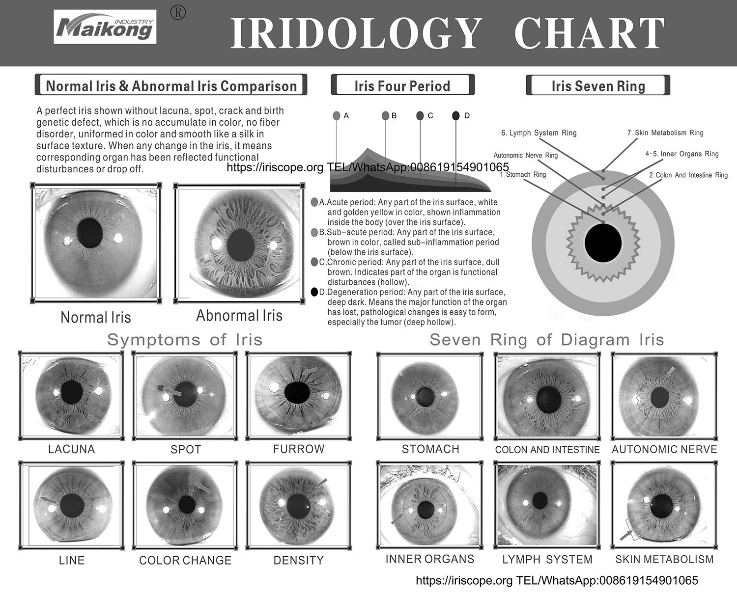 Chart Iridology 6 Comparativa de diferentes cartas iridológicas: Jensen, europea y rusa