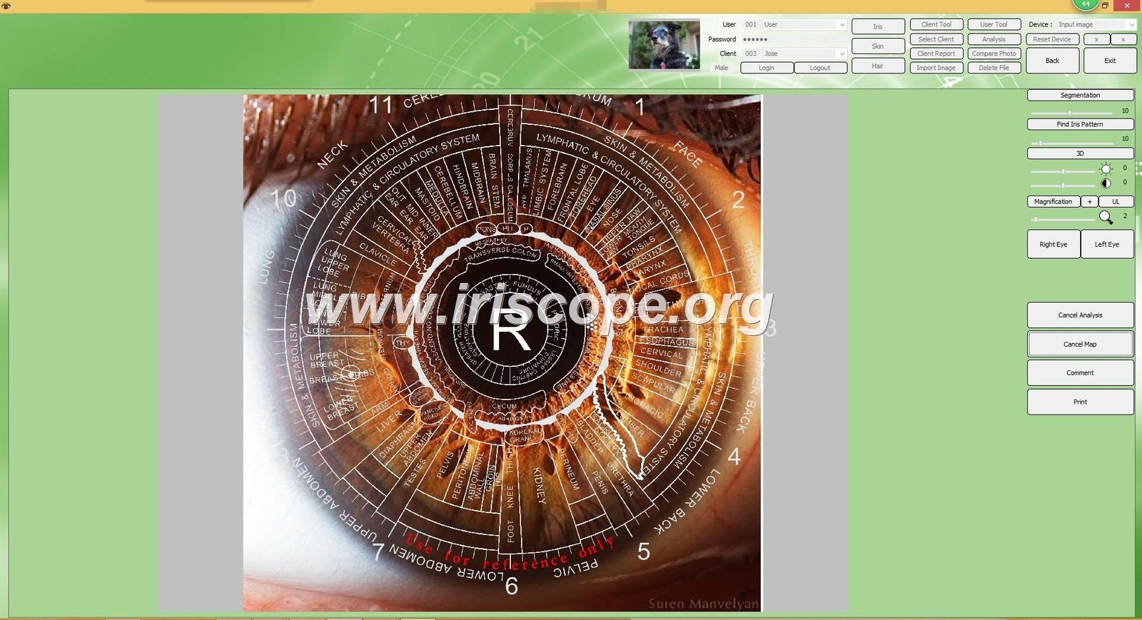 Software de Iridología (1)