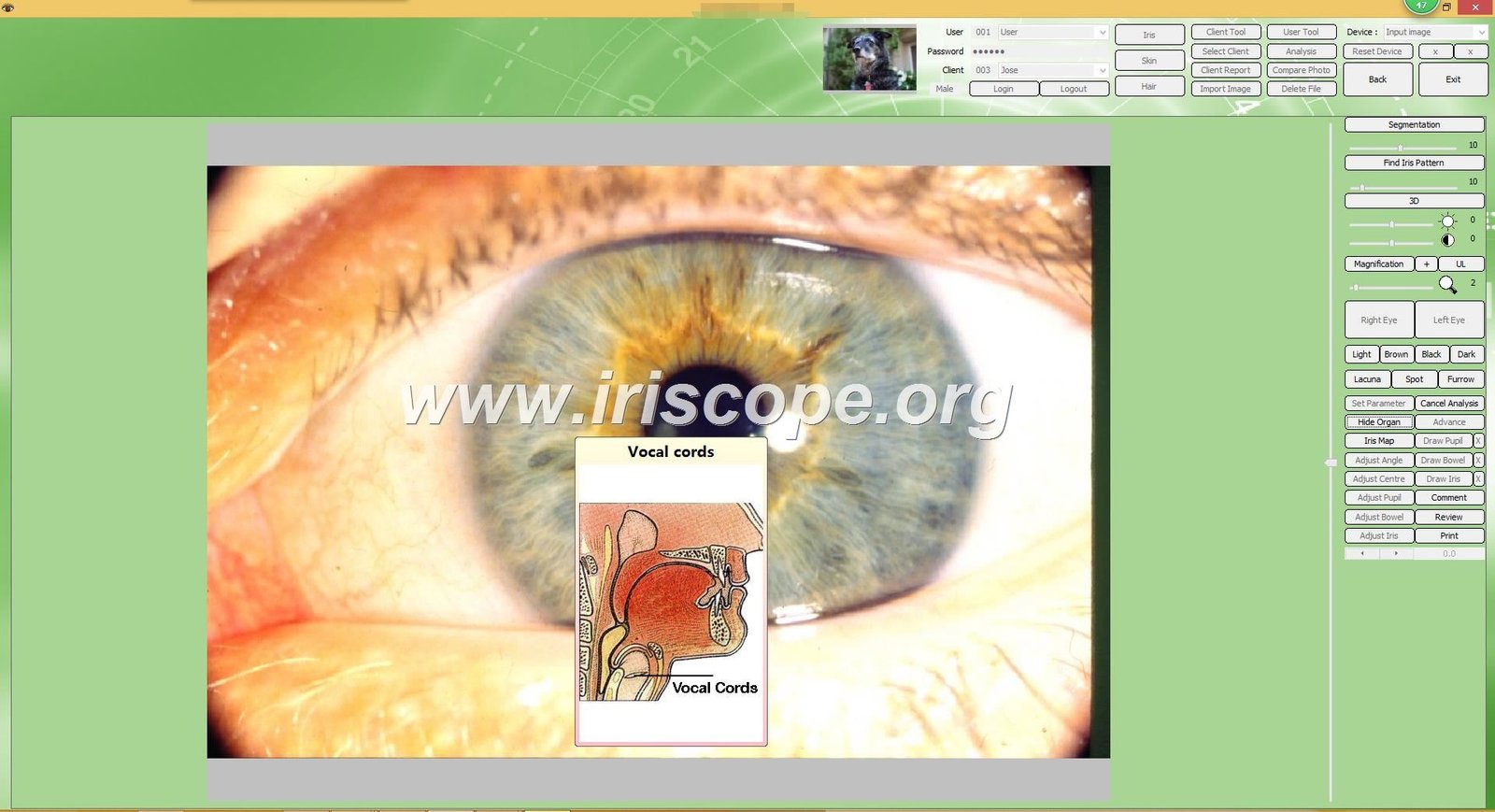 iridology software reports