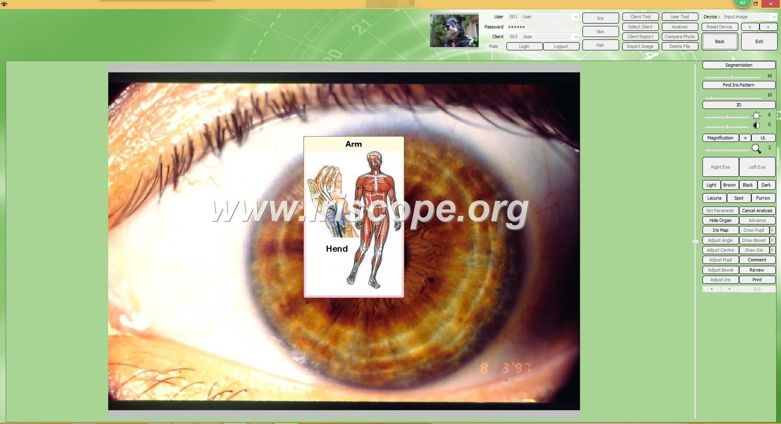 iridology software reports