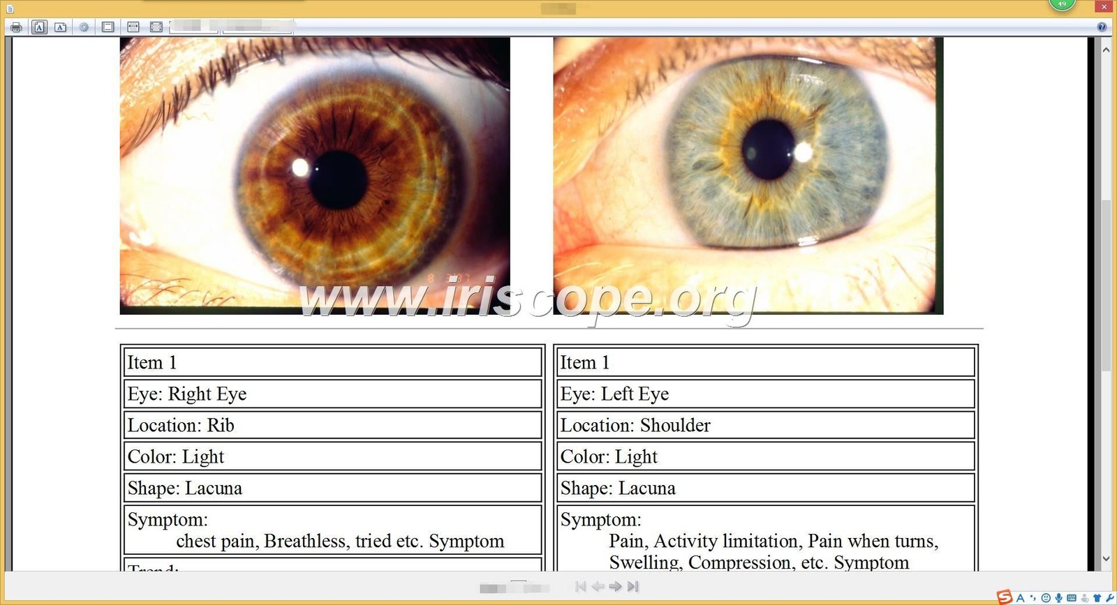 iridology software reports