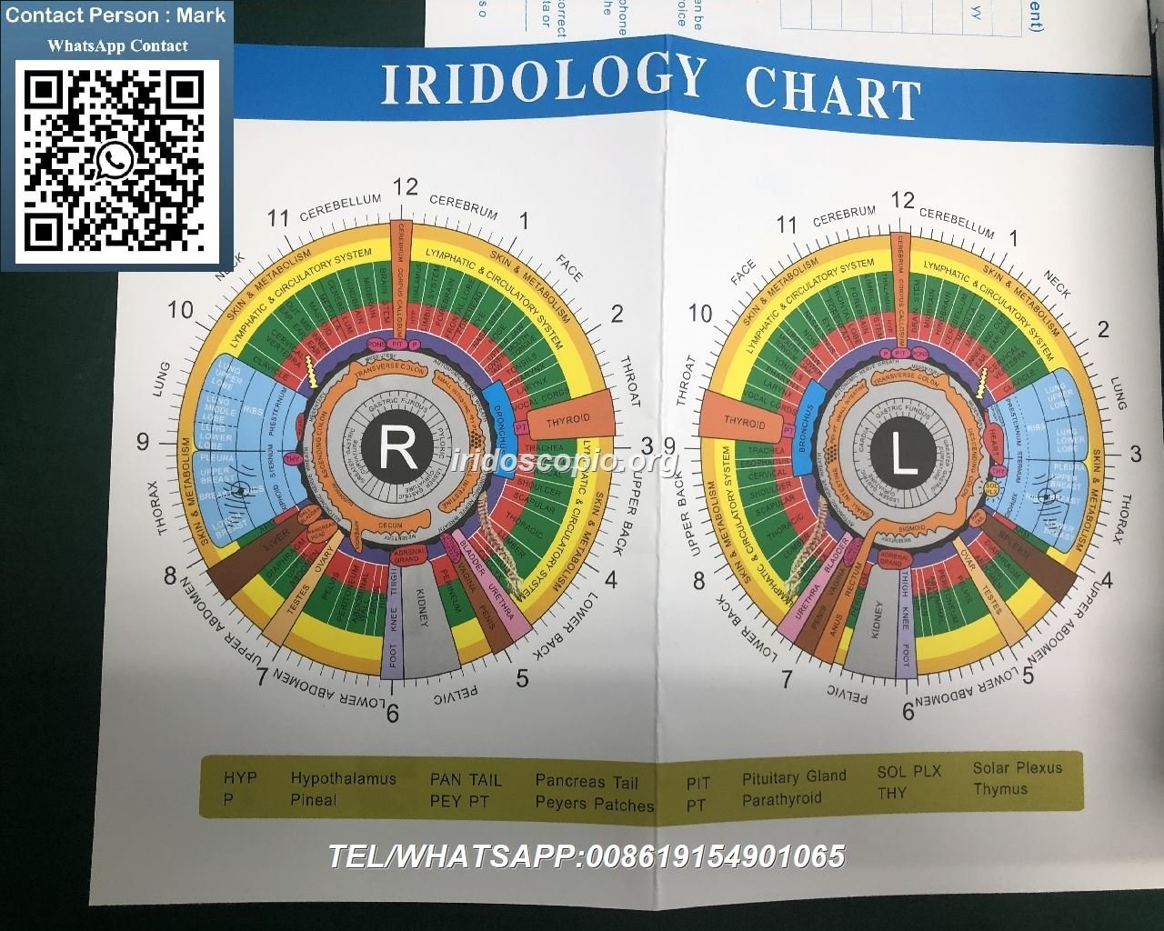 Equipo iriscopio MAIKONG mostrando características de calidad profesional y tecnología avanzada