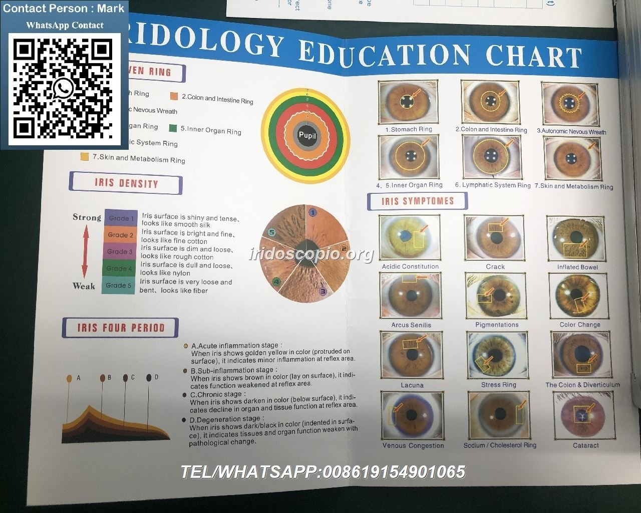 Equipo iriscopio MAIKONG mostrando características de calidad profesional y tecnología avanzada