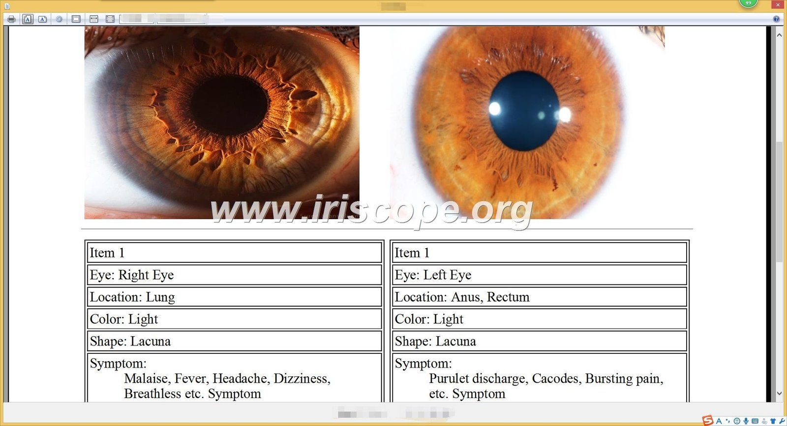 iridology software reports