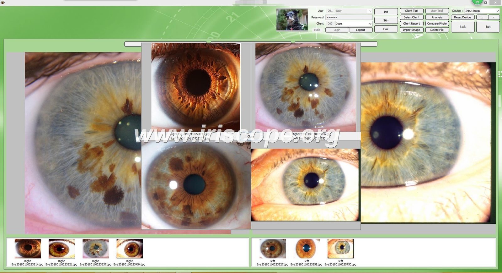 iridology software reports