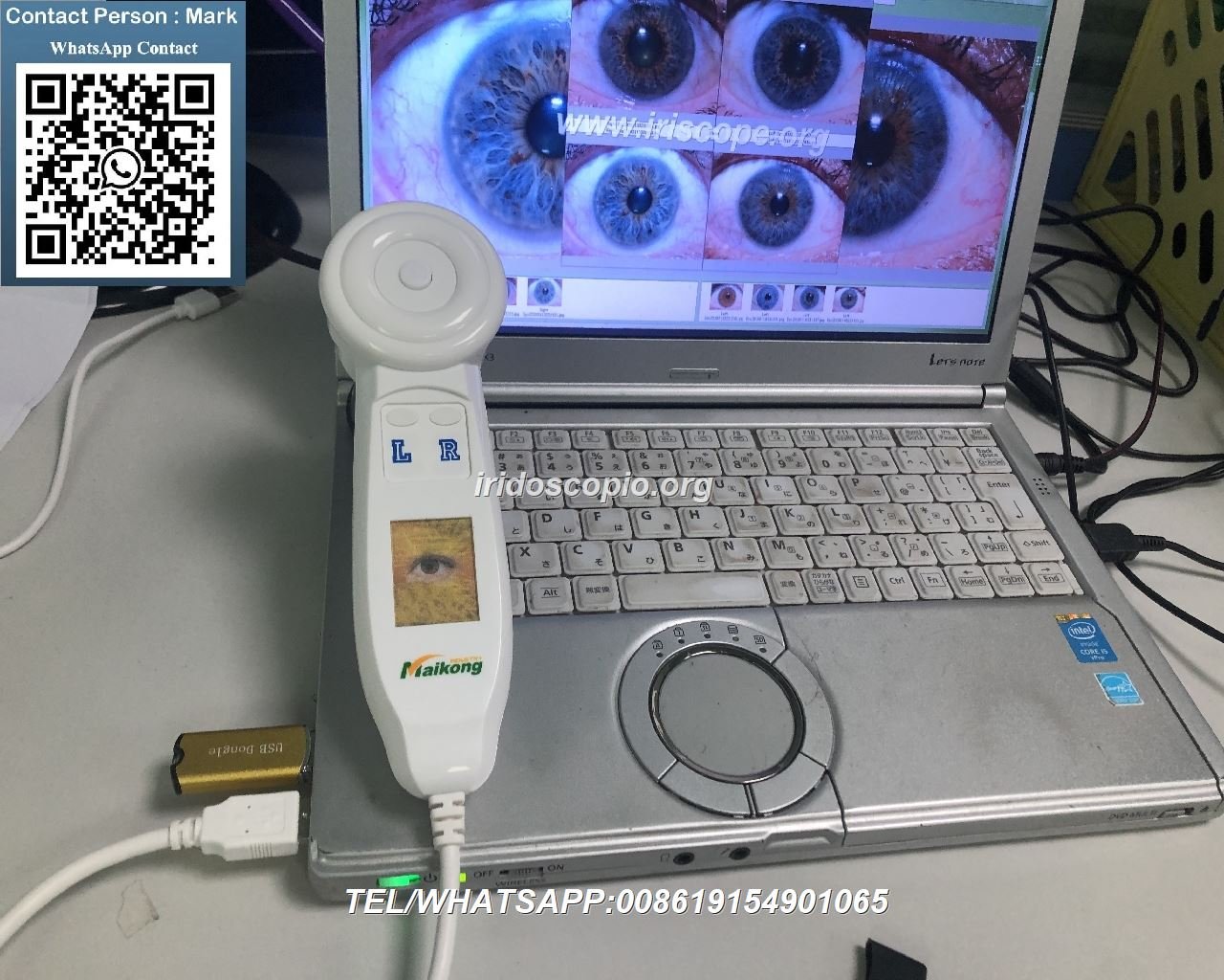 Iriscopio MAIKONG 12MP con sensor de alta resolución