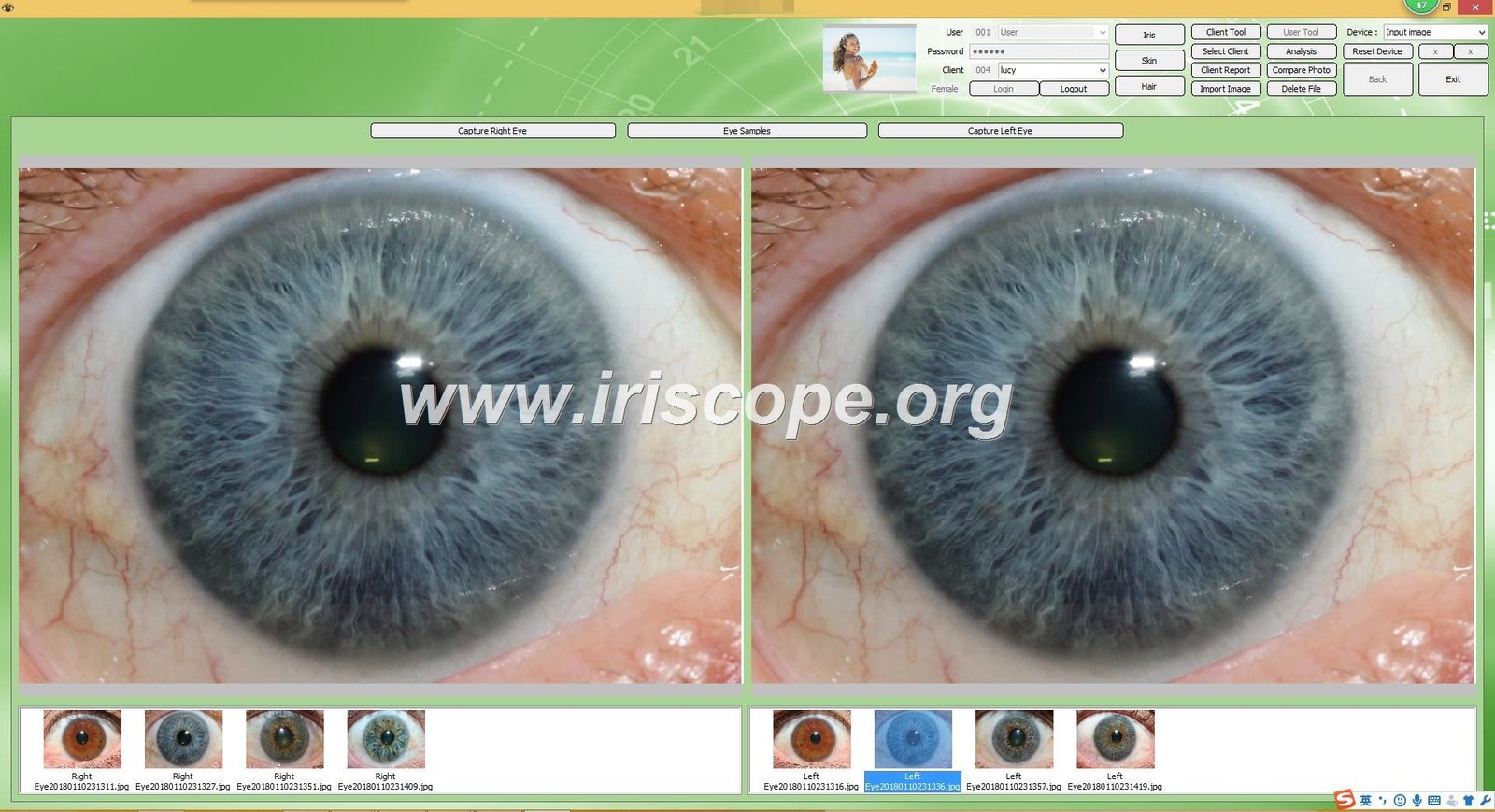 iridology software