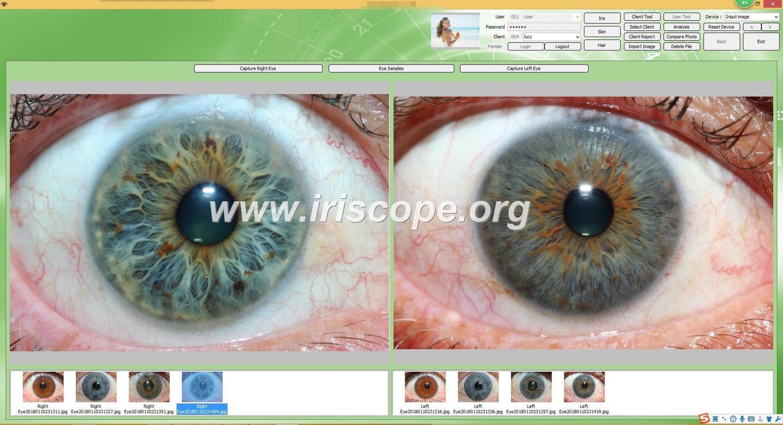 iridology software reports
