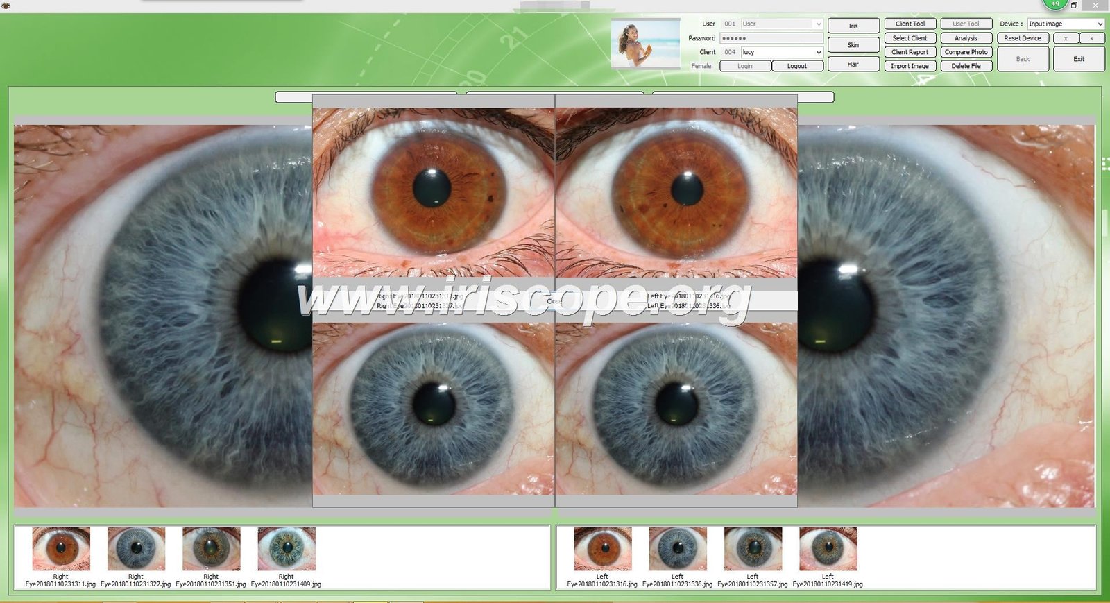 iridology software