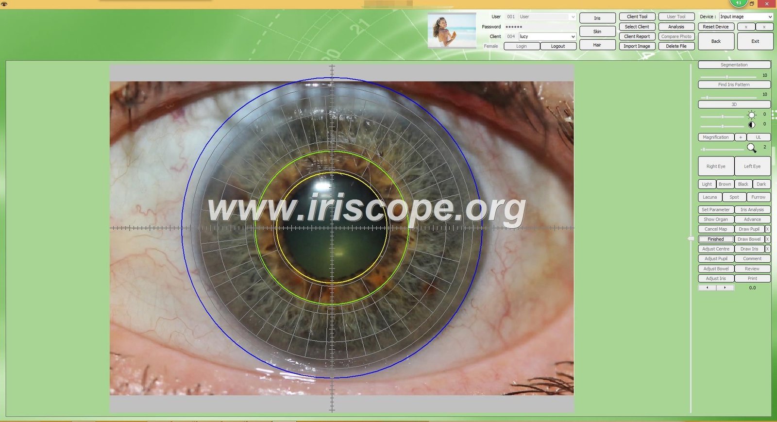 iridology software reports