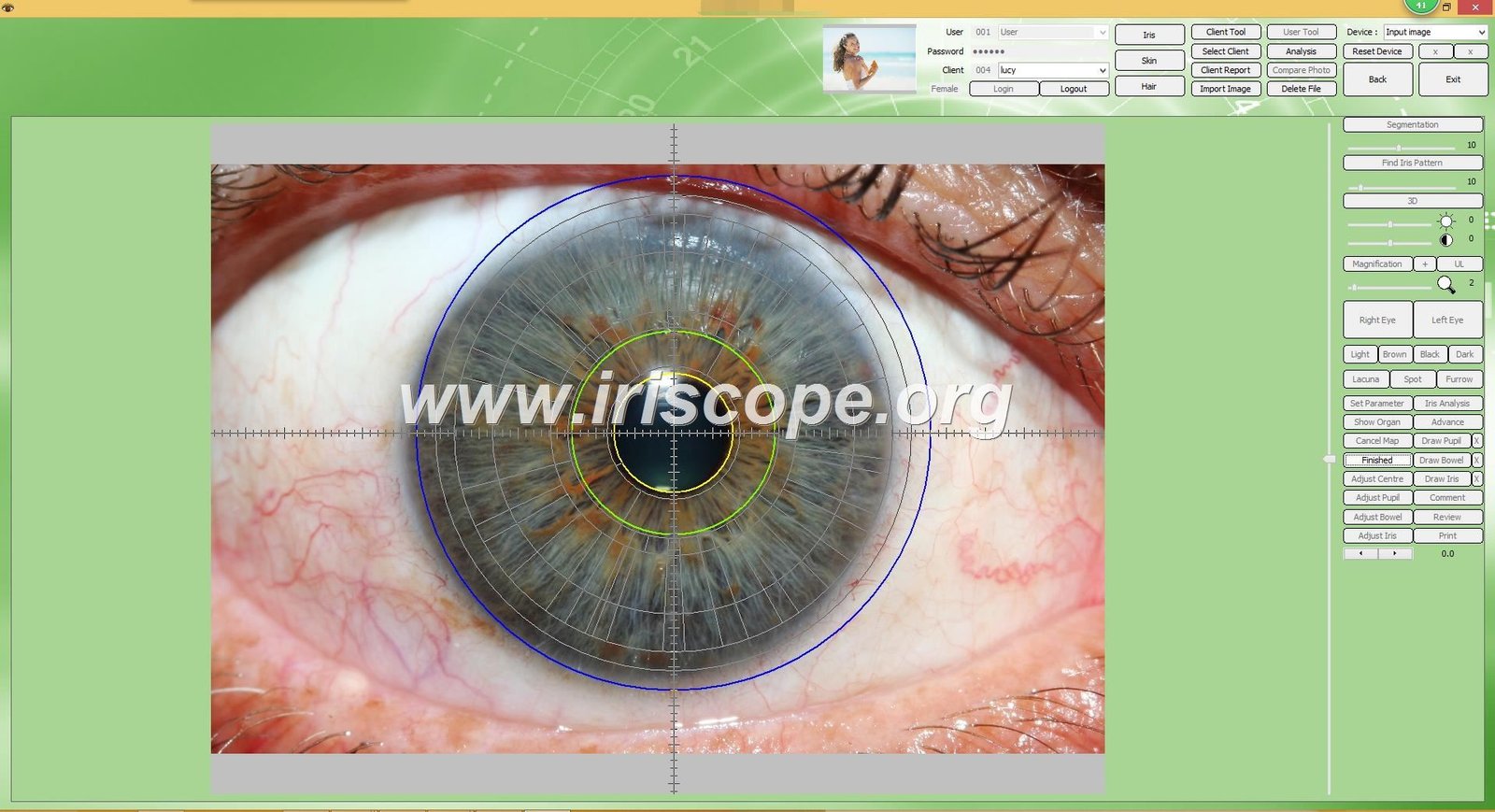 iridology software reports