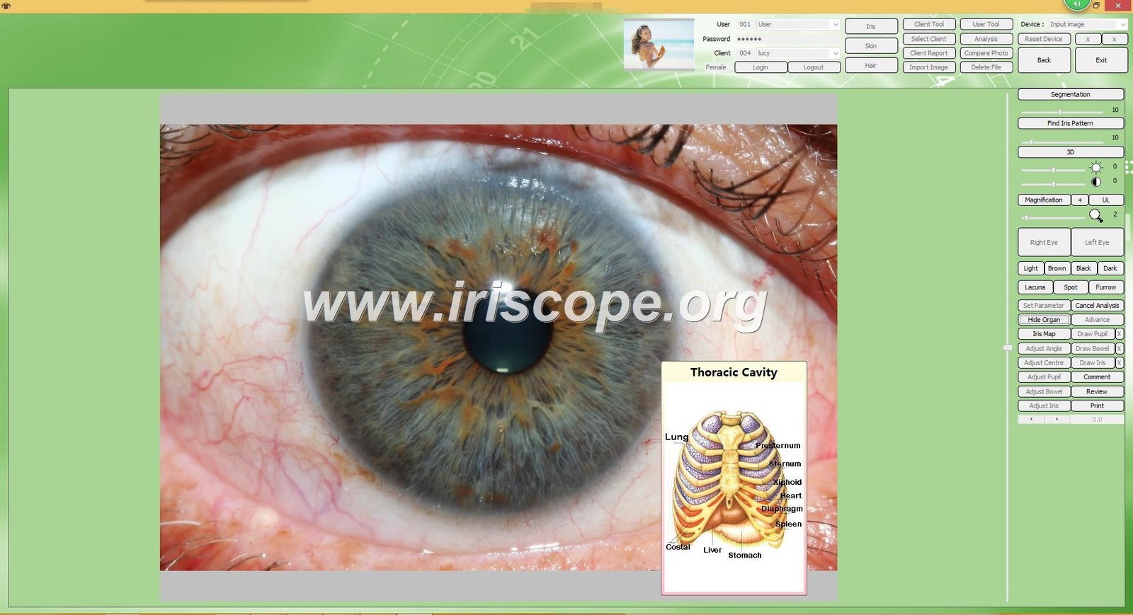 iridology software reports