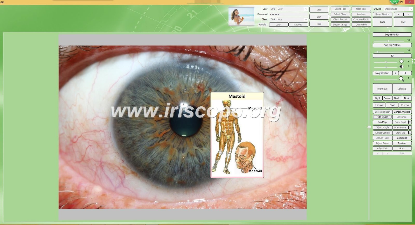 iridology software reports