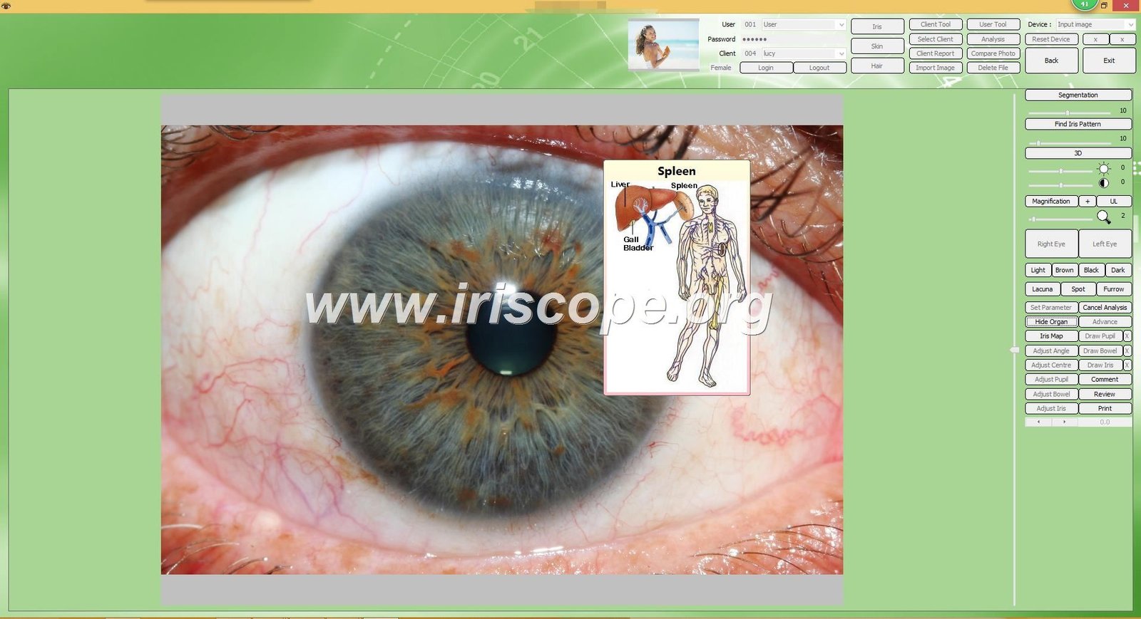 iridology software reports