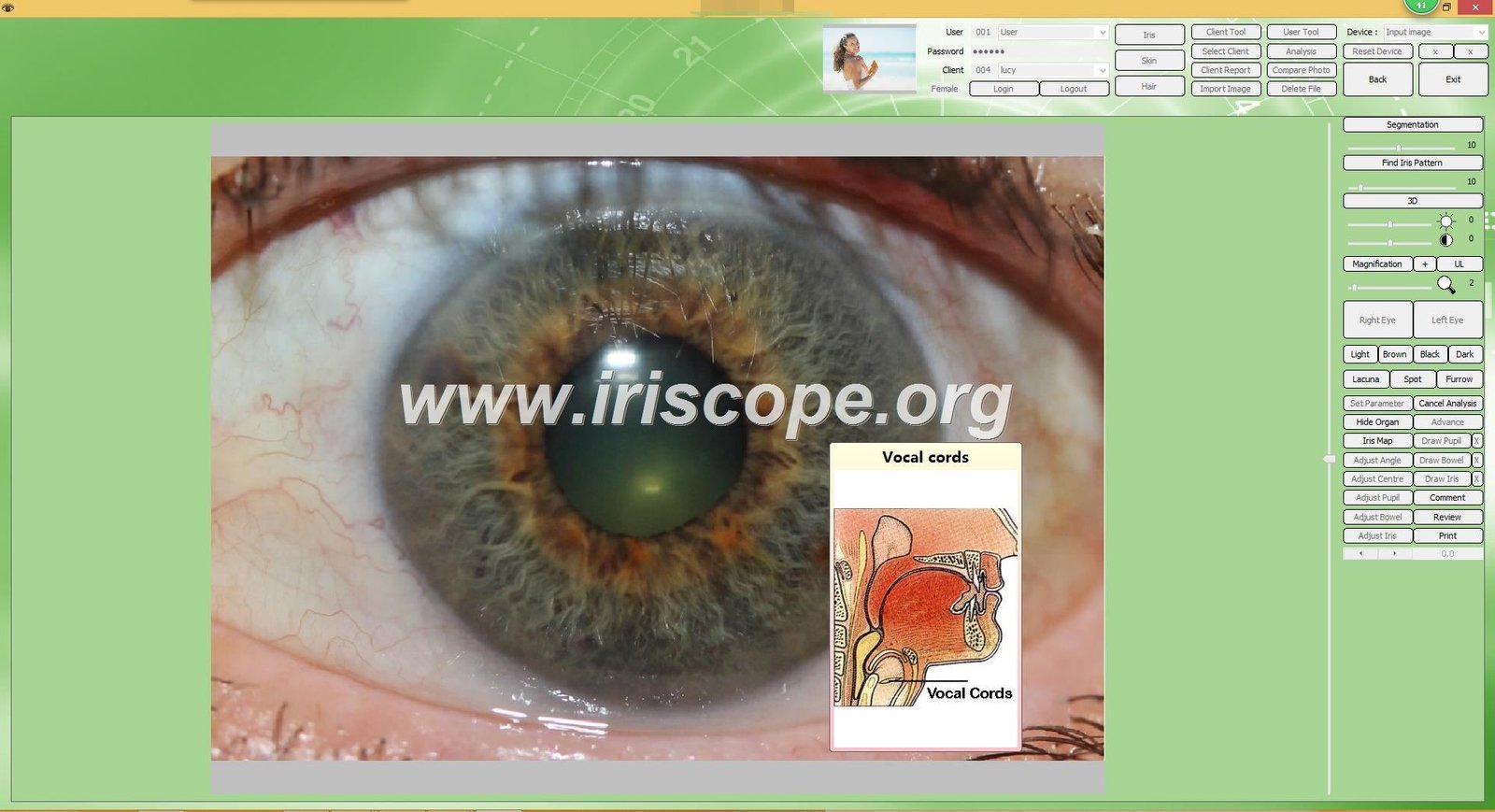 iridology software reports