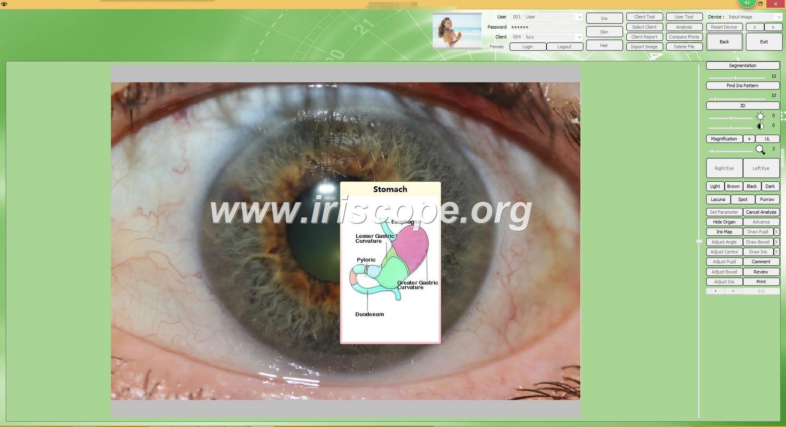 Software de Iridología (48)