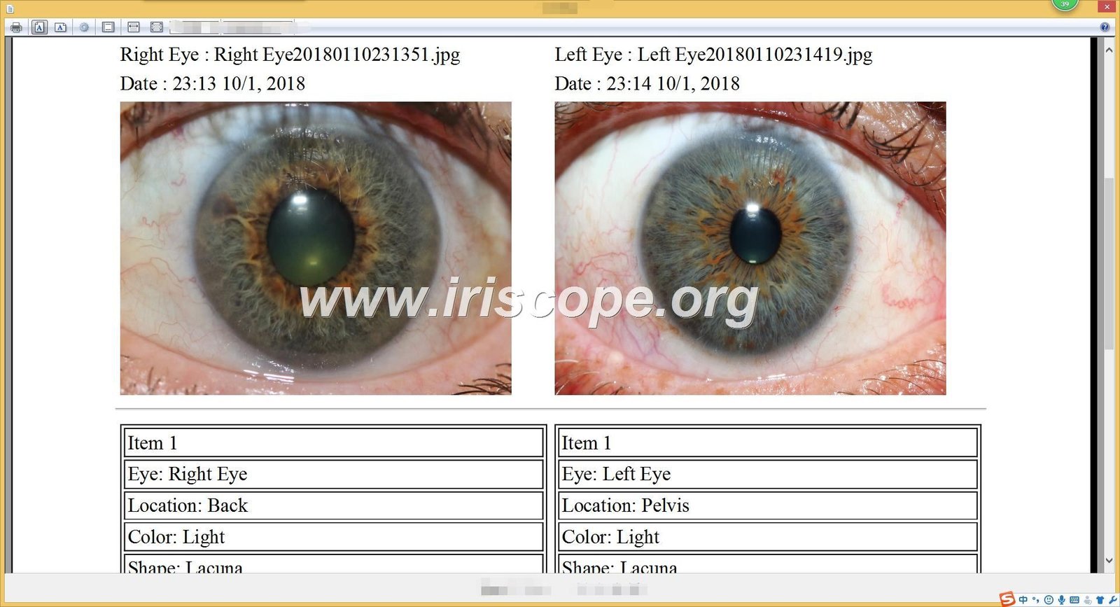iridology software reports