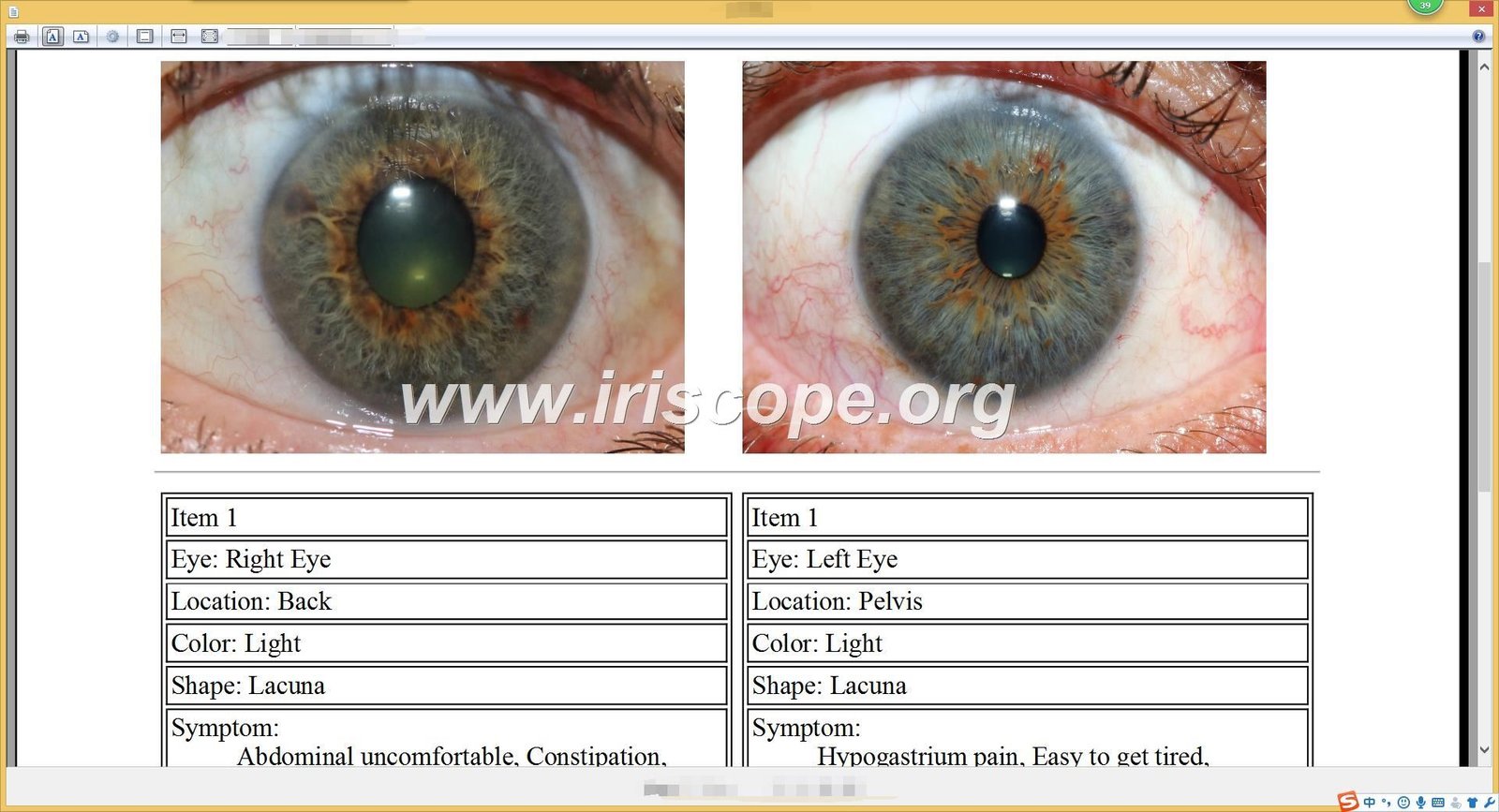 iridology software reports