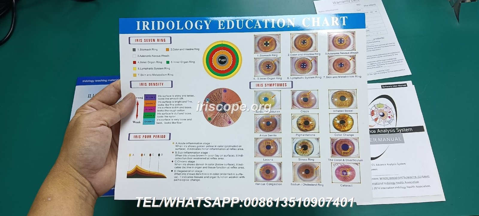 Iriscope Profesional MAIKONG de 12 megapixeles para análisis de iridología en clínica española