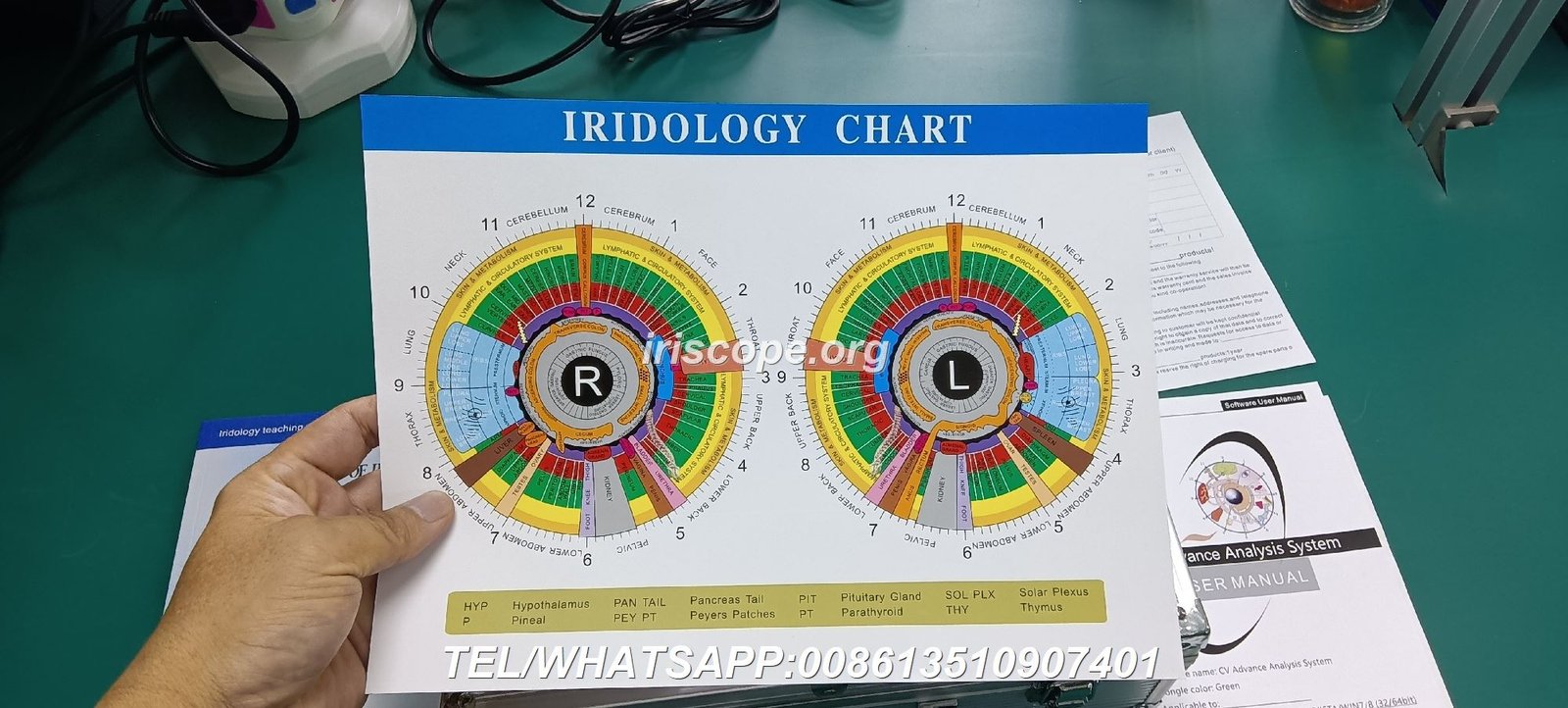 Iriscope Profesional MAIKONG de 12 megapixeles para análisis de iridología en clínica española