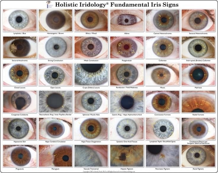 eye-color-charts-iris-eye