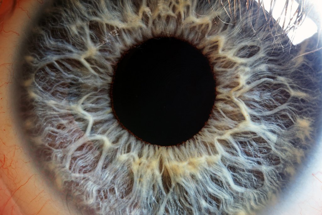 Curso Iridología País Vasco: Recursos Profesionales y Equipamiento para Análisis del Iris 3 Análisis profesional de iridología mostrando iris humano con mapa de zonas