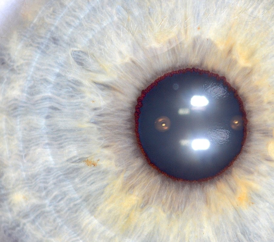 Análisis comparativo iris antes después tratamiento