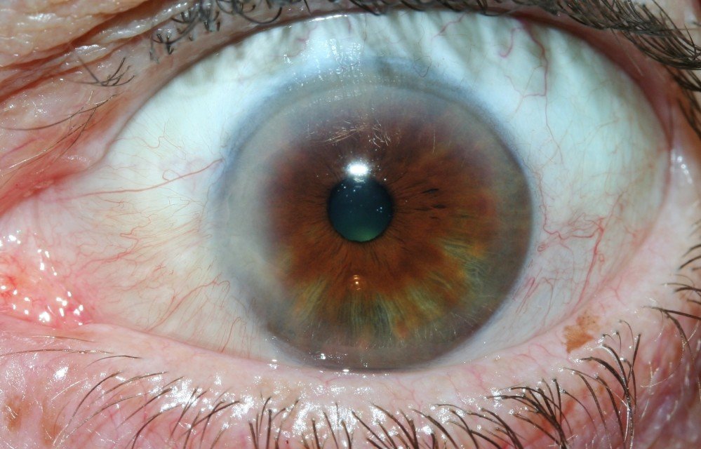 Beneficios de la Iridología: Una Guía Completa para Profesionales de la Salud 2 Vista detallada del iris humano mostrando los patrones y colores únicos utilizados en el análisis de iridología