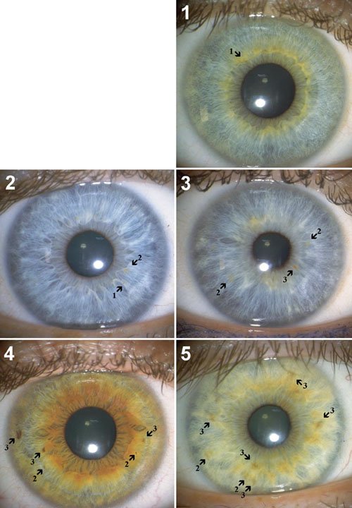 complete iridology startup kit