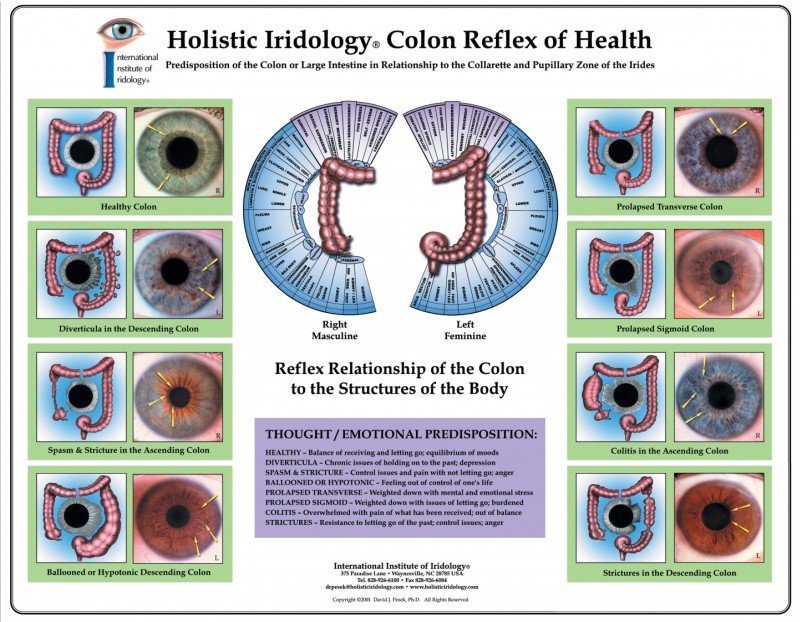 Chart Iridology 2 software iridología comparativa pantallas múltiples interfaces análisis iris profesional
