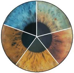 guía visual de interpretación de colores en iris según bernard jensen