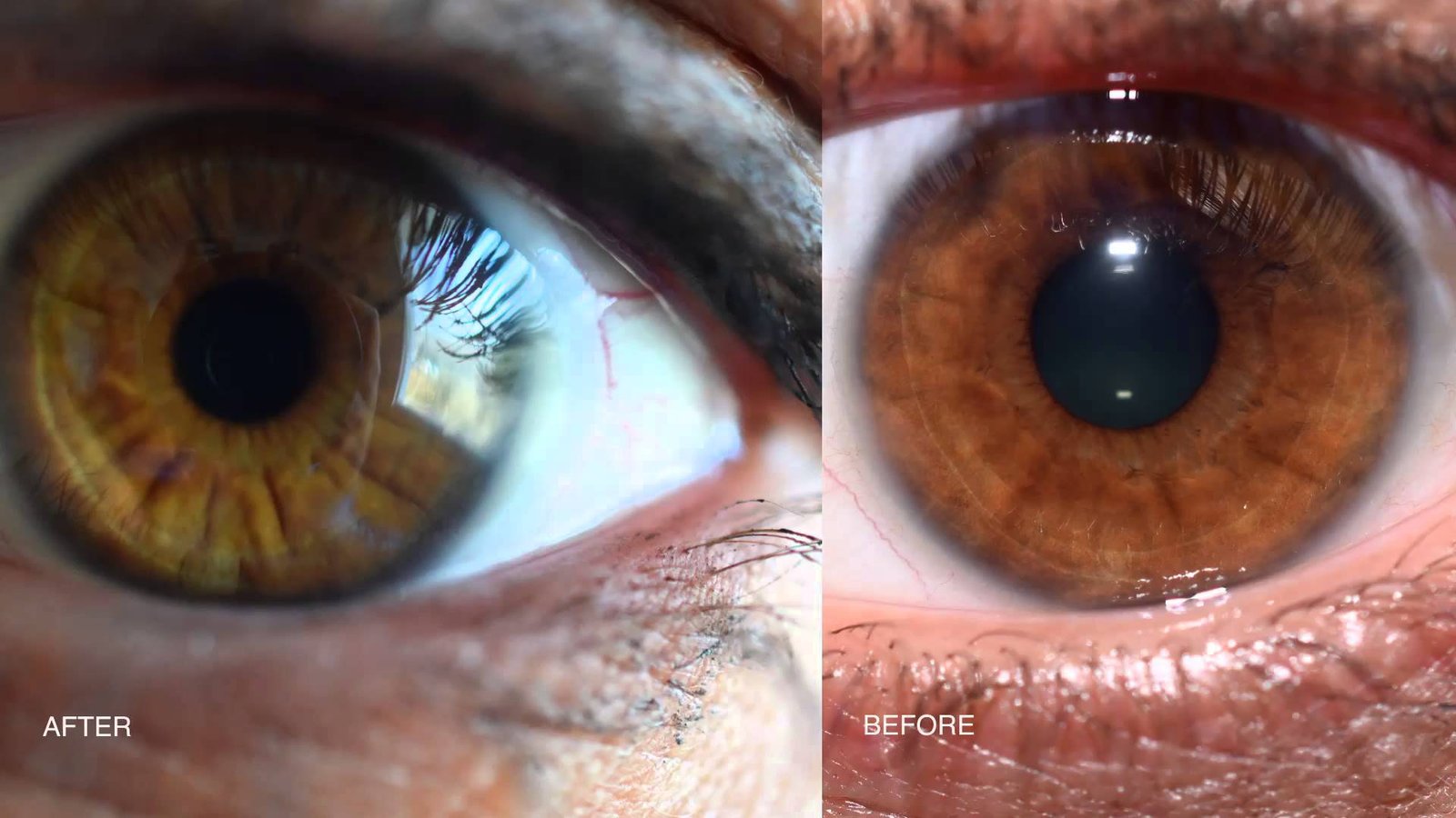 iridologia 8 iridology eye color change 1