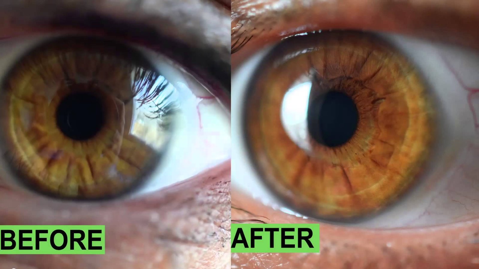 Comparación de fotos del mismo iris antes y después del tratamiento