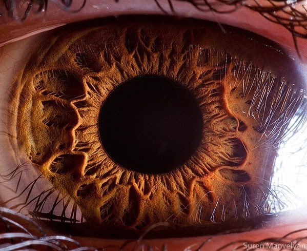 iridology images