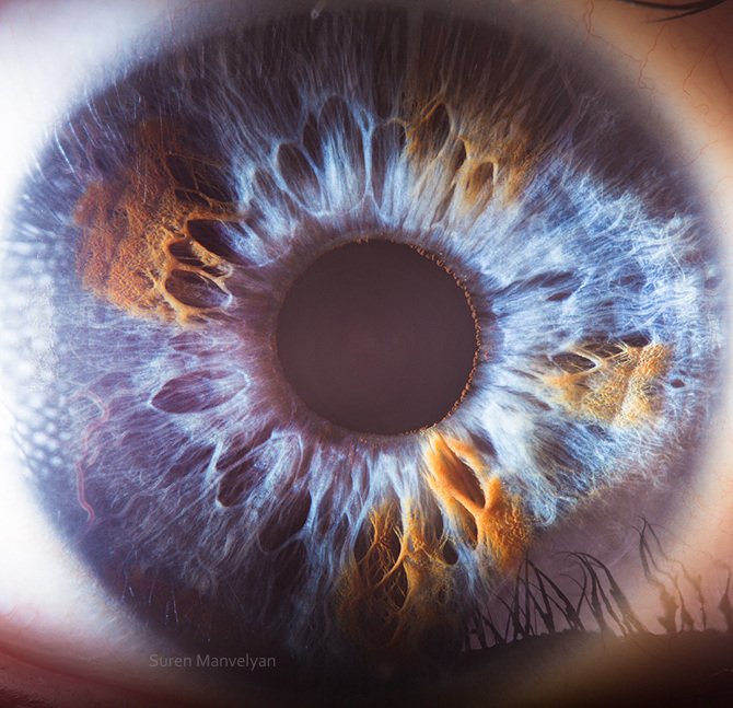 iridology images