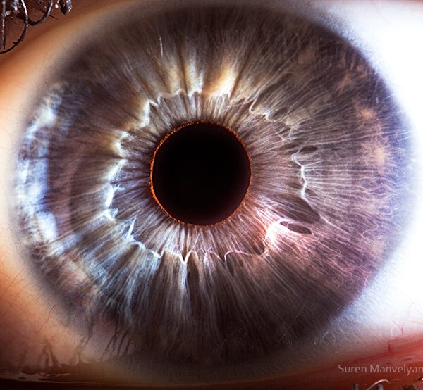 iridology images