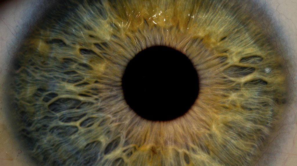iridology images