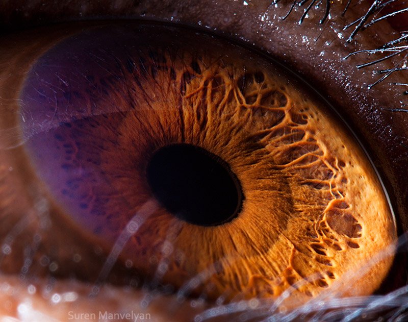 iridology images